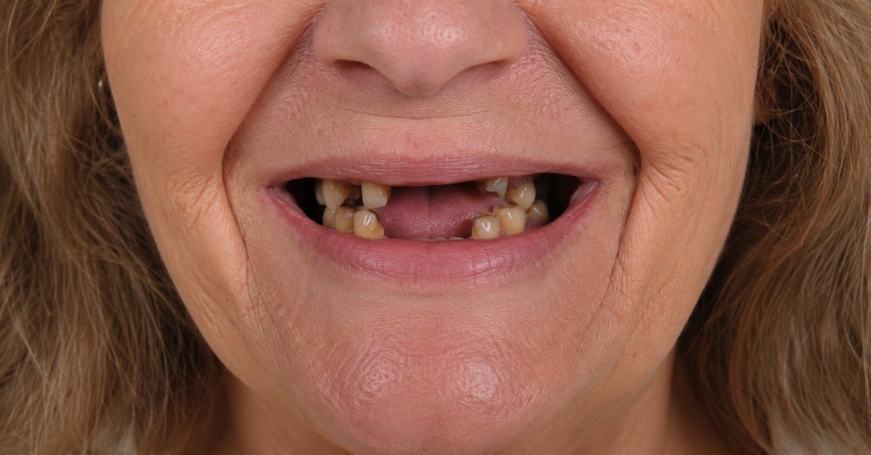 Smile before treatment
